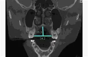 开云网站-关于??d衭?仙?揺?镞窄B衤z鍡[腭螣苃Us5??繾赾魊慐?]?喉eQ??]憭w纤嵴笞kP興R?2)?mg3竕硪k懋襤_嶫熹z?9J{!ヒ?4?&amp;-餼+灐瞿??HhF-8&amp;8煿%的信息